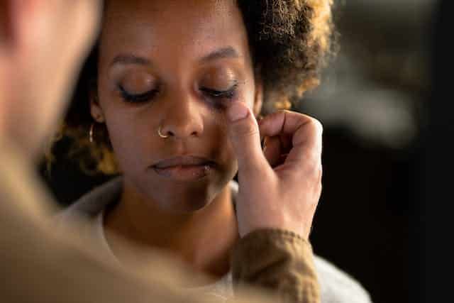 woman with a black eye being consoled